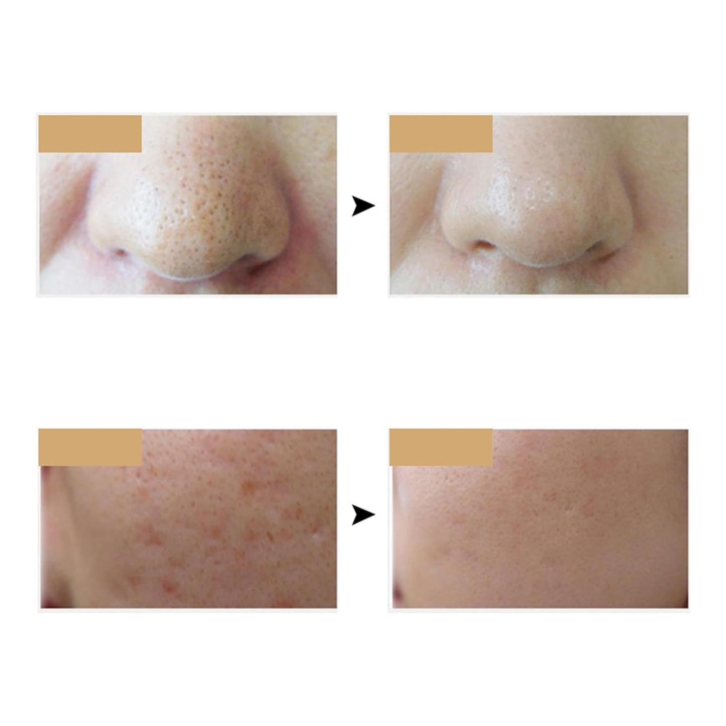 Mascarilla Facial LED